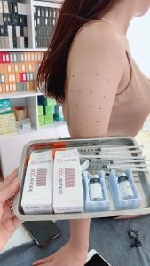 Khách hàng sử dụng Botulux 200 cho thon gọn bắp tay