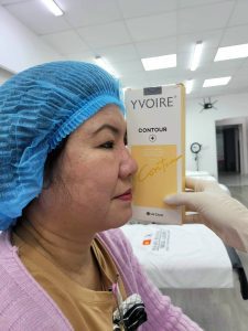 Nhiều khách hàng sử dụng Filler Yvoire