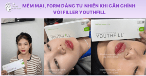 vào form mềm mại,tự nhiên với Filler Youthfill