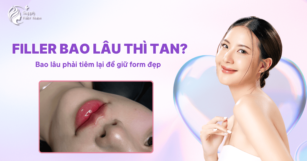 Filler Bao Lâu Thì Tan?