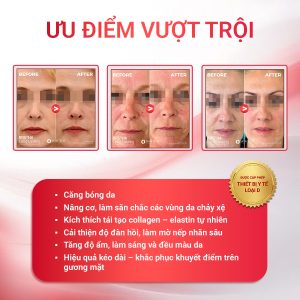 Ưu điểm vượt trội 