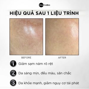 Khách hàng sử dụng Exocode