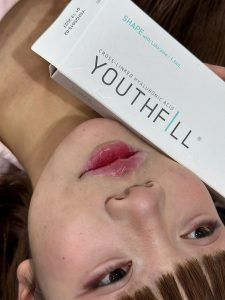Môi mềm mại,tự nhiên khi cân chỉnh bằng Filler Youthfill