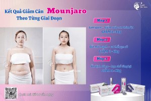 Kết quả giảm cân với bút Mounjaro